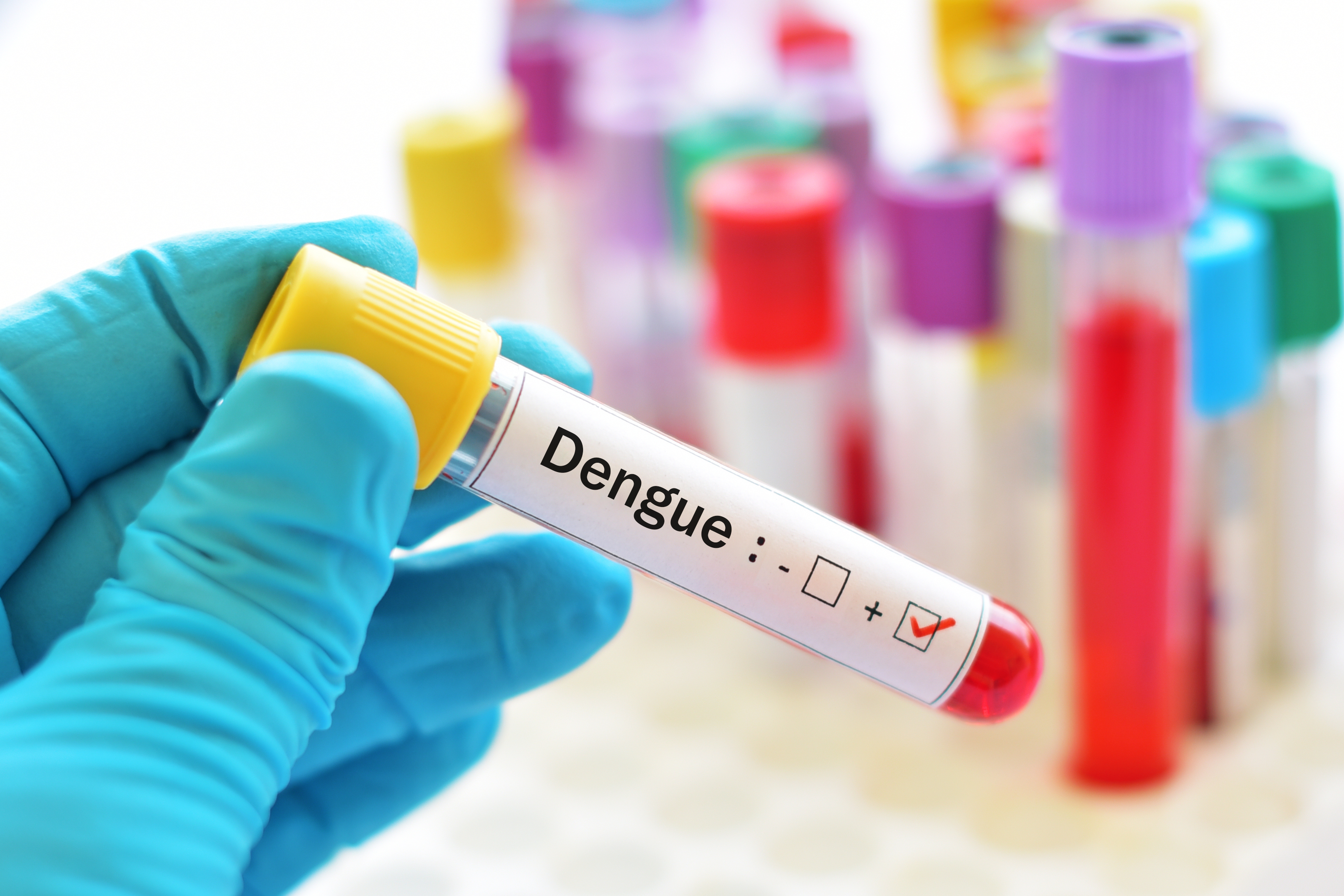 Un cas de transmission de la dengue par voie sexuelle en Espagne
